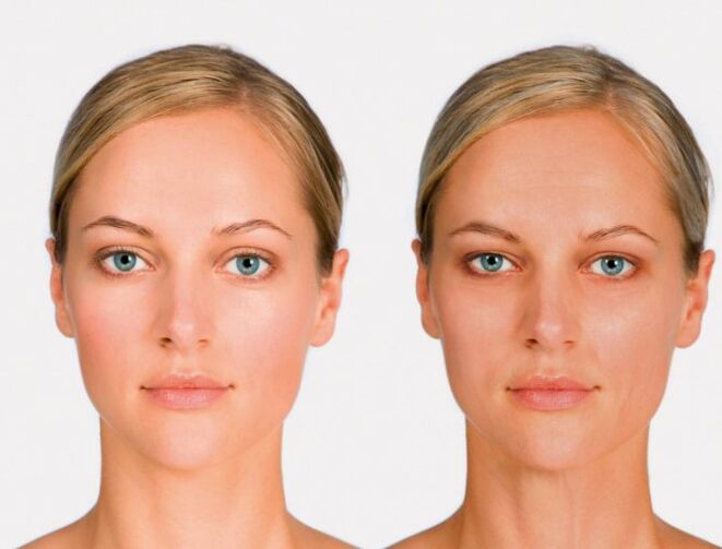 Face after and before rejuvenating