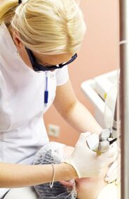 The doctor performs the photothermolysis procedure