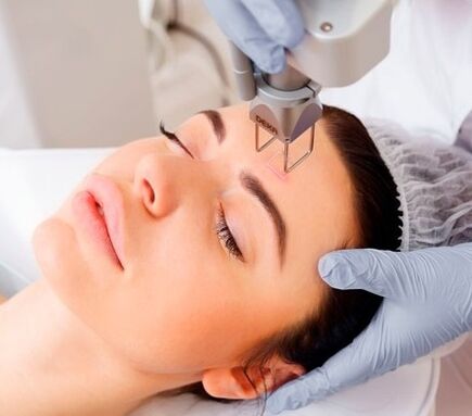The essence of fractional laser facial skin rejuvenation procedure