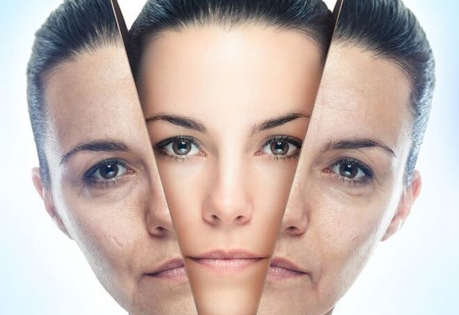 The process of removing facial skin from age-related changes